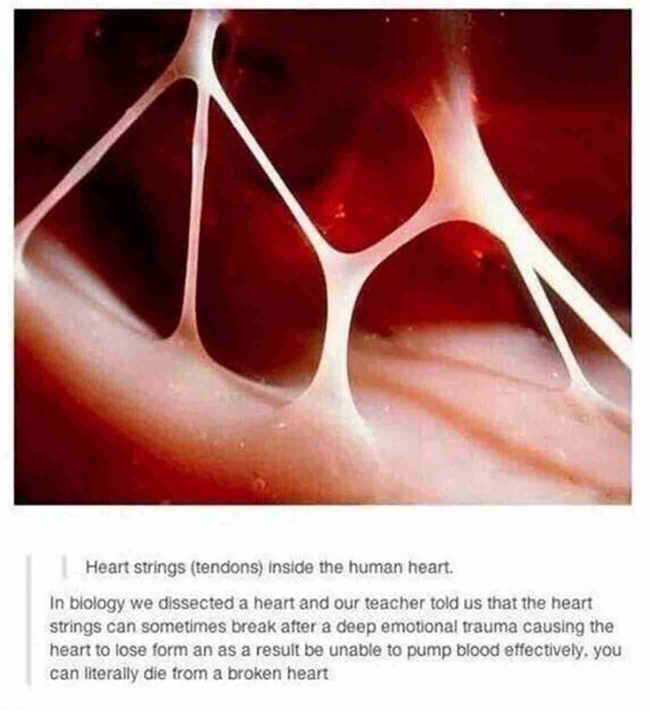 Image Of A Broken Heart Illustrating The Pain Of A Break Up Ed Bo Break Up #5 (Stoopid)