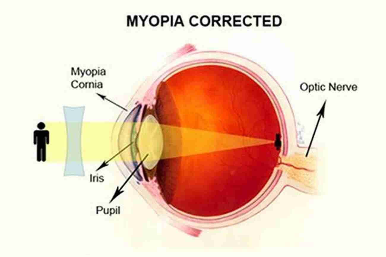 The Myopia The Myopia And Other Plays By David Greenspan (Critical Performances)